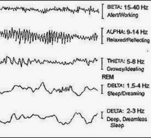 Brain wave activity during sleep