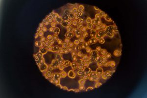 monatomic-cells-body-image